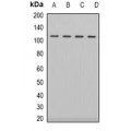 LifeSab™ Androgen Receptor Rabbit pAb (50 µl)