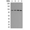 LifeSab™ MDM2 Rabbit pAb (50 µl)