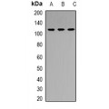 LifeSab™ RB1 Rabbit pAb (50 µl)