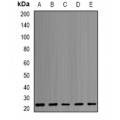 LifeSab™ PSMB1 Rabbit pAb (50 µl)