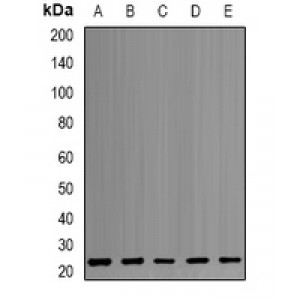 LifeSab™ PSMB1 Rabbit pAb (50 µl)