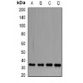 LifeSab™ PP1 beta Rabbit pAb (50 µl)