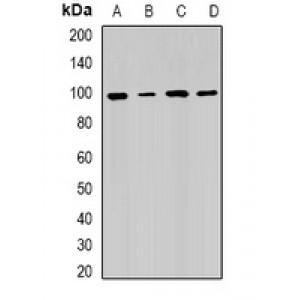 LifeSab™ RRM1 Rabbit pAb (50 µl)