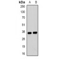 LifeSab™ Tropomyosin 3 Rabbit pAb (50 µl)