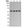 LifeSab™ RbAp48 Rabbit pAb (50 µl)