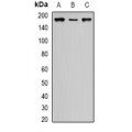 LifeSab™ SIN3A Rabbit pAb (50 µl)