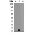 LifeSab™ PSMB9 Rabbit pAb (50 µl)