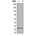 LifeSab™ DCK Rabbit pAb (50 µl)