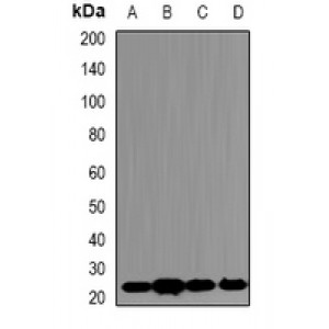 LifeSab™ PSMB5 Rabbit pAb (50 µl)