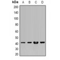 LifeSab™ HLA-A Rabbit pAb (50 µl)