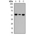 LifeSab™ PPP2R2A Rabbit pAb (50 µl)