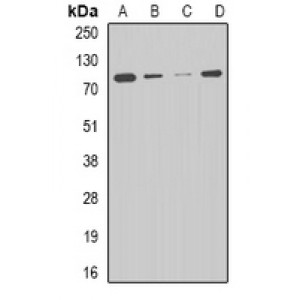 LifeSab™ CPT2 Rabbit pAb (50 µl)