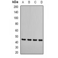 LifeSab™ RRM2 Rabbit pAb (50 µl)