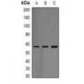 LifeSab™ ABAT Rabbit pAb (50 µl)