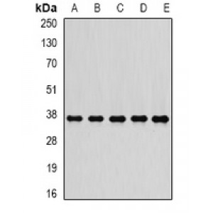 LifeSab™ PSMD7 Rabbit pAb (50 µl)