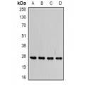 LifeSab™ VAP-B/C Rabbit pAb (50 µl)