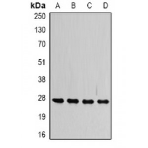LifeSab™ VAP-B/C Rabbit pAb (50 µl)