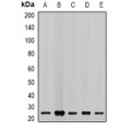 LifeSab™ CHMP2B Rabbit pAb (50 µl)