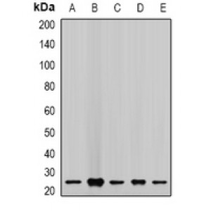 LifeSab™ CHMP2B Rabbit pAb (50 µl)