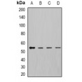 LifeSab™ DLD Rabbit pAb (50 µl)