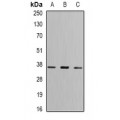 LifeSab™ FBP1 Rabbit pAb (50 µl)