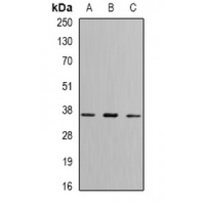 LifeSab™ FBP1 Rabbit pAb (50 µl)