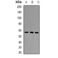 LifeSab™ PCCB Rabbit pAb (50 µl)