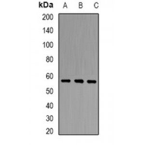 LifeSab™ PCCB Rabbit pAb (50 µl)