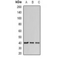 LifeSab™ FIH-1 Rabbit pAb (50 µl)