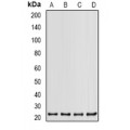 LifeSab™ PSMB2 Rabbit pAb (50 µl)