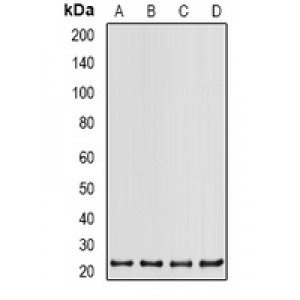 LifeSab™ PSMB2 Rabbit pAb (50 µl)