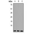 LifeSab™ Sm E Rabbit pAb (50 µl)