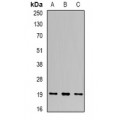 LifeSab™ UBE2C Rabbit pAb (50 µl)