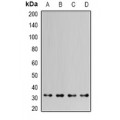 LifeSab™ HAX1 Rabbit pAb (50 µl)