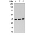LifeSab™ RING1b Rabbit pAb (50 µl)