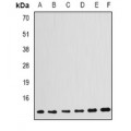 LifeSab™ GABARAP Rabbit pAb (50 µl)