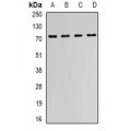 LifeSab™ FMR1 Rabbit pAb (50 µl)