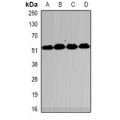 LifeSab™ MeCP2 Rabbit pAb (50 µl)