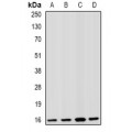 LifeSab™ Fis1 Rabbit pAb (50 µl)