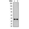 LifeSab™ JMJD6 Rabbit pAb (50 µl)