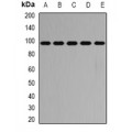 LifeSab™ PYGB Rabbit pAb (50 µl)