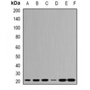 LifeSab™ RPL9 Rabbit pAb (50 µl)