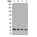 LifeSab™ SNRPA Rabbit pAb (50 µl)