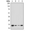 LifeSab™ Tim17 Rabbit pAb (50 µl)