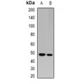 LifeSab™ AGAT Rabbit pAb (50 µl)