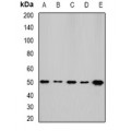 LifeSab™ NFS1 Rabbit pAb (50 µl)