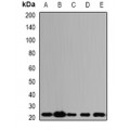 LifeSab™ ALG-2 Rabbit pAb (50 µl)