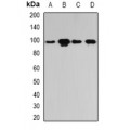 LifeSab™ PYGL Rabbit pAb (50 µl)