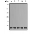 LifeSab™ Sm-D2 Rabbit pAb (50 µl)