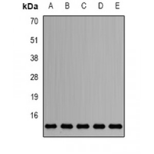 LifeSab™ Sm-D2 Rabbit pAb (50 µl)